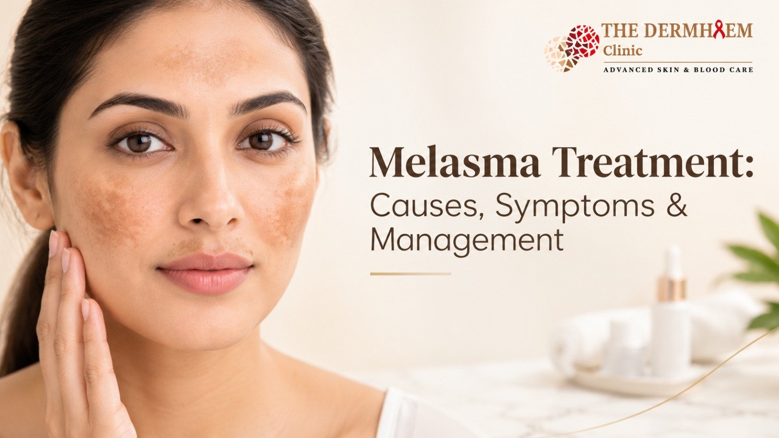 Melasma Treatment: Causes, Symptoms & Management